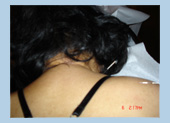 acupuncture houston tx